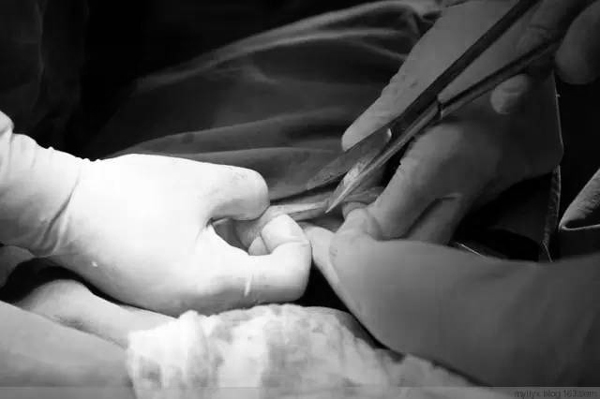 Khi đau đẻ ai cũng đòi mổ nhưng mẹ có biết một ca sinh mổ đau đớn thế nào không? - 13