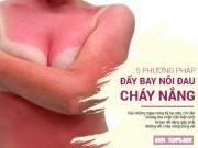 Đẹp - Khắc phục lập tức tình trạng da bỏng rát do cháy nắng bằng 5 phương pháp "chẳng tốn đồng nào"