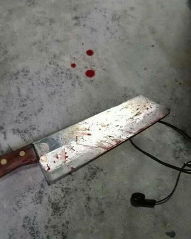 Phát hiện chồng ngoại tình, người phụ nữ dùng dao cắt đứt amp;#34;cậu nhỏamp;#34; rồi ném qua cửa sổ - 3