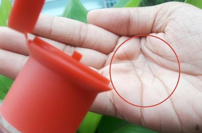Điểm mặt 5 toner làm sạch kiêm trị mụn luôn trong tình trạng hết hàng vì quá hot! - 2
