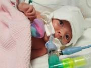 Bà bầu - Mang thai suôn sẻ đến gần tháng cuối, mẹ sốc khi bác sĩ báo con "ruột lộn lên ngực"