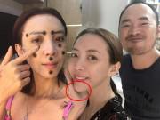 Làm đẹp - HOT: Đây là phản ứng của "Hoa hậu hài" Thu Trang trước nghi vấn độn cằm