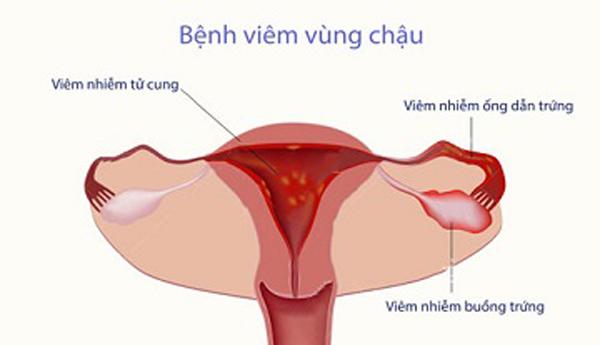 khi hu co mui tanh, nguyen nhan do dau? - 2 khi hu co mui tanh, nguyen nhan do dau? - 2