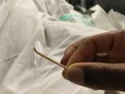 Chuẩn bị mang thai - Cấy que tránh thai gây vô kinh: Chị em hốt hoảng, bác sĩ khẳng định: “Chuyện hết sức bình thường”