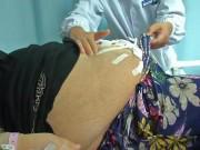 Bà bầu - Mổ đẻ gấp vì thai chết lưu, cảnh tượng bên trong bụng khiến bác sĩ không thể tin nổi