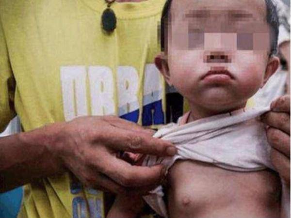 Tắm cho cháu gái 4 tuổi bà phát hiện thấy máu chảy, 1 tháng sau đi khám mới hối hận - 1