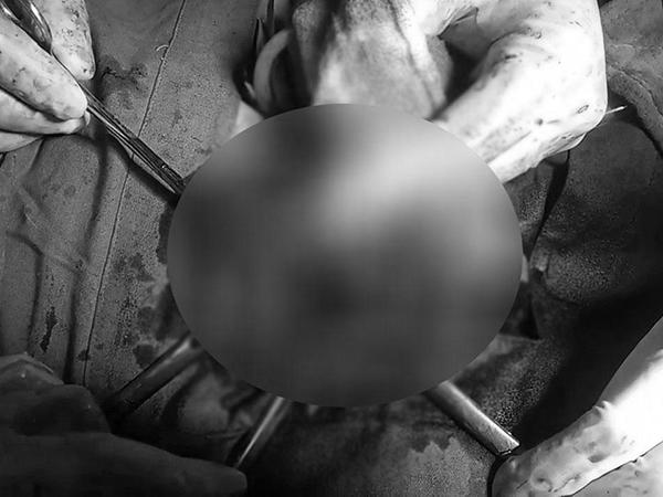 Đang mải mê amp;#34;yêuamp;#34;, người đàn ông bị amp;#34;gãy súngamp;#34; nhưng 12 tiếng sau mới phát hiện ra - 2