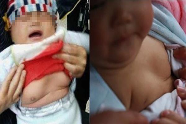 Tắm cho cháu gái 4 tuổi bà phát hiện thấy máu chảy, 1 tháng sau đi khám mới hối hận - 2