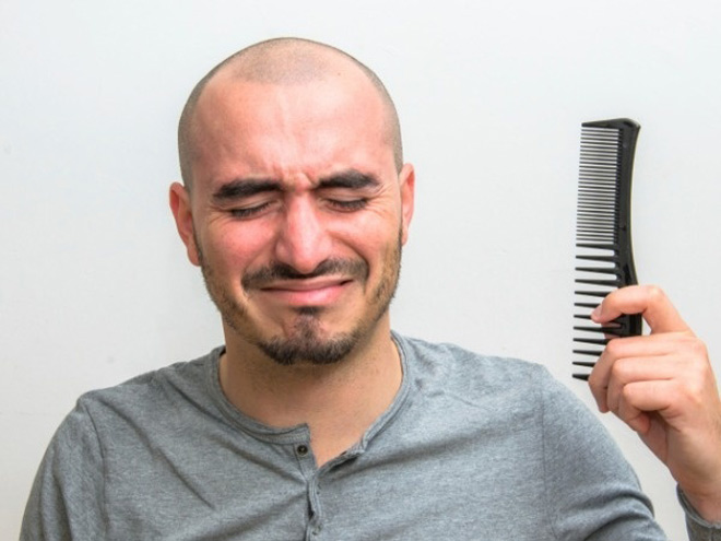 Kỹ thuật dệt tóc hói 3D giúp tạm biệt ngay “đường bay sáng chói” ở trên đầu - 2