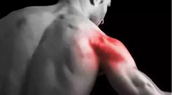 Nữ sinh nhập viện cấp cứu sau khi tập... 200 lần động tác nâng mông chị em thi nhau làm - 3