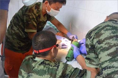 Thủ dâm với... cờ-lê và loạt tai nạn khóc dở mếu dở vì muốn amp;#34;thử cảm giác mớiamp;#34; - 3