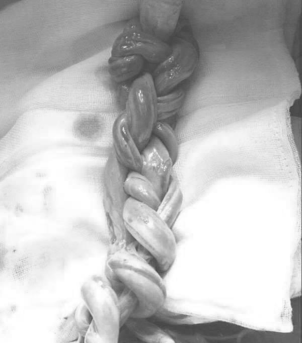 Chờ mong mỏi mòn mới có được cặp song thai, bác sĩ lại nói amp;#34;Đừng vội khoe mọi ngườiamp;#34; - 2