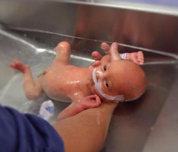 Chờ mong mỏi mòn mới có được cặp song thai, bác sĩ lại nói amp;#34;Đừng vội khoe mọi ngườiamp;#34; - 3