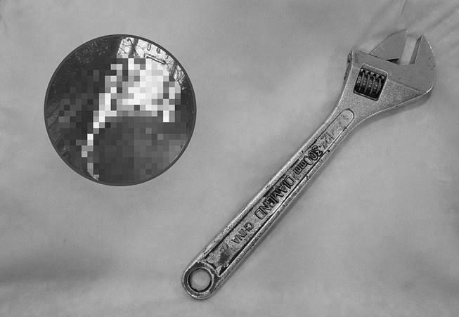 Thủ dâm với... cờ-lê và loạt tai nạn khóc dở mếu dở vì muốn amp;#34;thử cảm giác mớiamp;#34; - 2