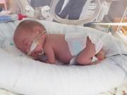 Bà bầu - Kỳ tích sống sót của bé sinh non nặng 3 lạng, xuất viện được bác sĩ mở tiệc chúc mừng