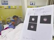 Sức khỏe - Để 2 con ở nhà chăm nhau, bố mẹ không ngờ điều này vô tình khiến con bị sỏi thận