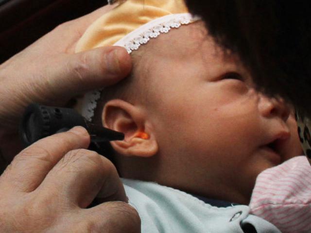 Bị viêm tai giữa dùng 1 tháng kháng sinh không đỡ, bé khỏi bệnh sau 10 ngày với cách này - 2