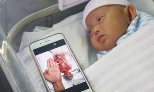 Bé sinh non nhỏ bằng bàn tay mẹ, bác sĩ liên tục thông báo gia đình amp;#34;chuẩn bị tinh thầnamp;#34; - 4