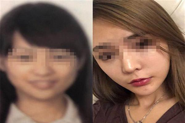 Hậu phẫu thuật thẩm mỹ: Chẳng thể lên máy bay, con khóc thét vì không nhận ra mẹ - 1