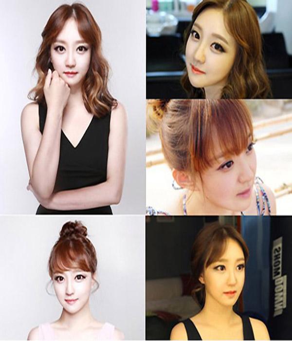 Hậu phẫu thuật thẩm mỹ: Chẳng thể lên máy bay, con khóc thét vì không nhận ra mẹ - 4