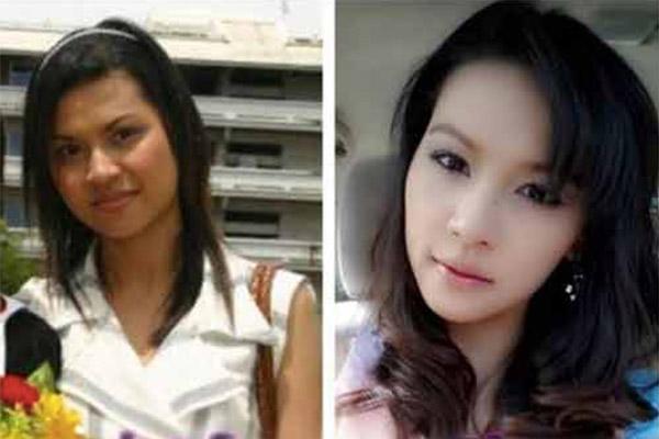 Hậu phẫu thuật thẩm mỹ: Chẳng thể lên máy bay, con khóc thét vì không nhận ra mẹ - 6