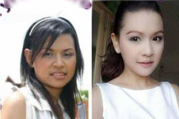 Hậu phẫu thuật thẩm mỹ: Chẳng thể lên máy bay, con khóc thét vì không nhận ra mẹ - 7