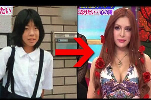 Hậu phẫu thuật thẩm mỹ: Chẳng thể lên máy bay, con khóc thét vì không nhận ra mẹ - 8