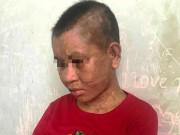 Tin tức - Hàng trăm vết thương trên người nữ giúp việc bị chủ nhà tra tấn như thời trung cổ