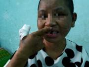 Tin tức - Cuộc chạy trốn khỏi "địa ngục trần gian" của cô gái giúp việc nghi bị chủ tra tấn dã man