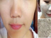 Làm đẹp - 4 cách trị mụn ẩn giúp nhân tự khắc trồi lên mà không cần nặn