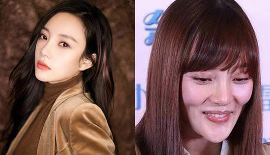 Những đại mỹ nhân Hoa ngữ giữ tuổi xuân sai cách khiến mặt amp;#34;méo móamp;#34; - 5