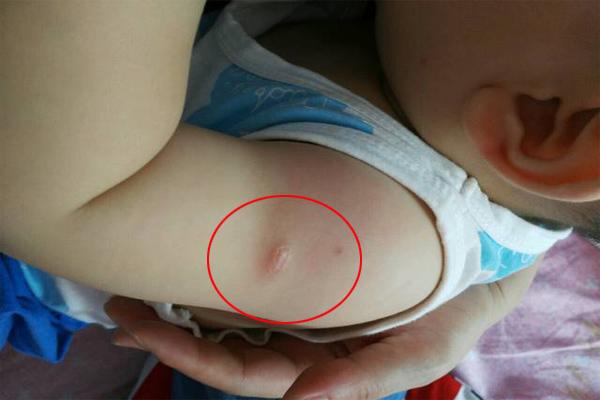 Nói dối cháu đang cảm là khỏe mạnh để được tiêm phòng, ông bà ân hận vì hậu quả - 2