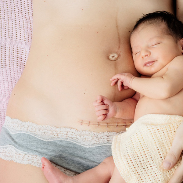 Chia tay những vết sẹo bằng cách quá đơn giản ai cũng có thể làm - 1