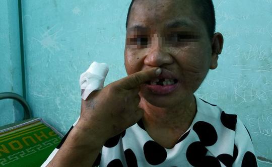 Giúp việc 9X bị chủ bạo hành đến sảy thai: Cứ amp;#34;chơi đáamp;#34; là ra tay tra tấn - 1