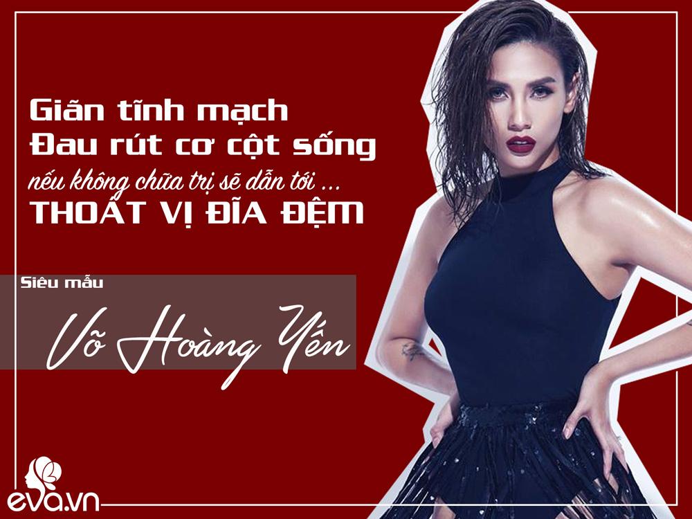 Không phải amp;#34;Chân dài - Đại giaamp;#34;, đây mới là góc khuất đen tối nhất của nghề người mẫu - 4