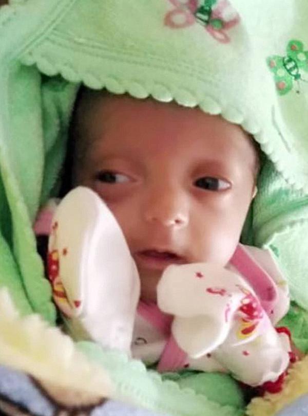 Mẹ suy sụp khi sinh con chưa được 4 lạng nhưng 4 tháng sau, điều kỳ diệu đã xảy ra - 1