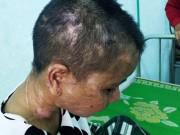 Tin tức - Vụ nữ giúp việc bị tra tấn như thời trung cổ: Truy tìm nghi can thứ 2?