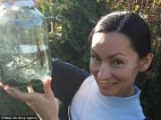 Sức khỏe - Cho 500 con đỉa vào tử cung trị u xơ, người phụ nữ không ngờ kết quả ngoài mong đợi