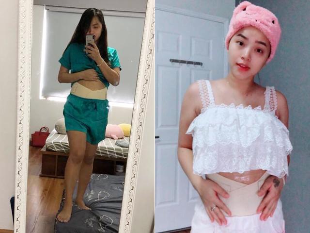 Vừa tháo chỉ sau đẻ mổ 5 ngày, Hải Băng được bác sĩ dặn: Em cuốn đai vào bụng nhé!