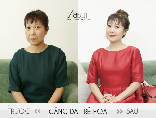 Bí ẩn chuyện tình khó tin của nghệ sĩ hài Thu Hương với chồng kém 9 tuổi - 4