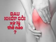 Sức khỏe - Nguyên nhân đau khớp gối do đâu?