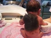 Bà bầu - Mẹ sinh con da thú vì thói quen liều lĩnh nhiều người thường làm khi mang bầu