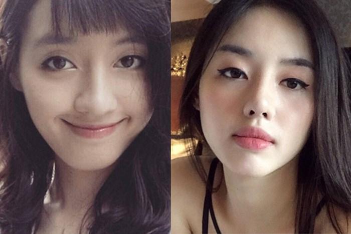 Hết chuyện bố ruột tự tay sửa mũi, cô nàng này lại amp;#34;bóc giáamp;#34; gương mặt lên đến 250 triệu - 1