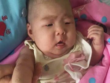 4 dấu hiệu ở trẻ chứng tỏ não chậm phát triển, nguy cơ thiểu năng trí tuệ