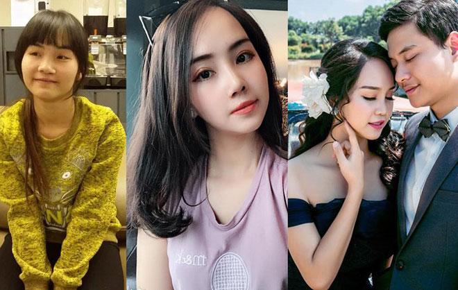 Những cô gái, chàng trai Việt amp;#34;lột xácamp;#34; nhờ thẩm mỹ có sợ sinh con như bản gốc? - 1