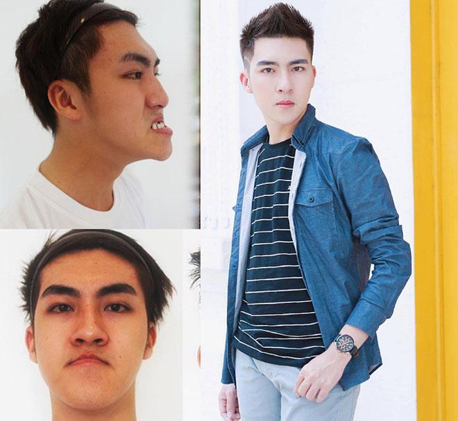 Những cô gái, chàng trai Việt amp;#34;lột xácamp;#34; nhờ thẩm mỹ có sợ sinh con như bản gốc? - 2