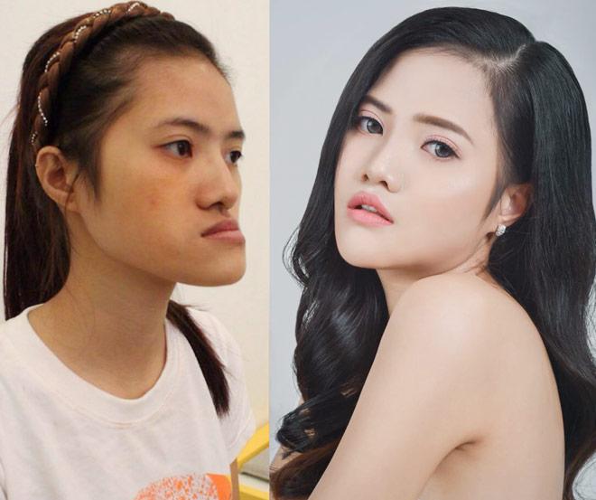 Những cô gái, chàng trai Việt amp;#34;lột xácamp;#34; nhờ thẩm mỹ có sợ sinh con như bản gốc? - 4