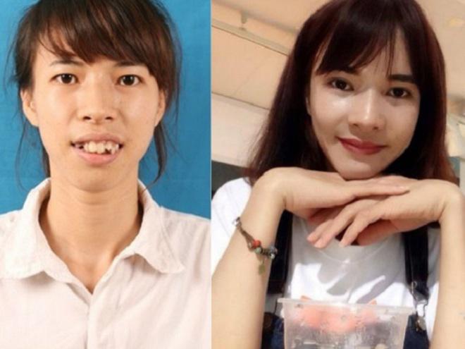 Những cô gái, chàng trai Việt amp;#34;lột xácamp;#34; nhờ thẩm mỹ có sợ sinh con như bản gốc? - 5