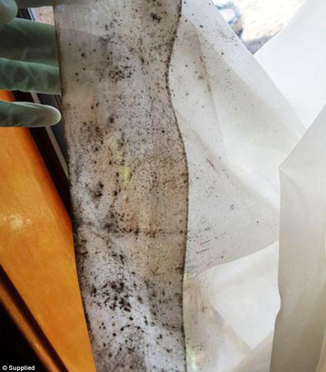 4 năm đi viện 160 lần, cô gái tưởng nghén thai kỳ nào ngờ do thứ không tưởng trong nhà - 4