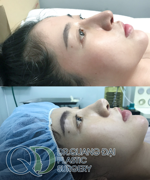 BS Trịnh Quang Đại - bàn tay tiên phong “nhào nặn” nên dáng mũi Latin - 1